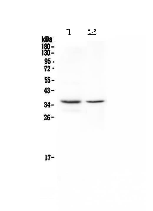 CD8A / CD8 Alpha Antibody