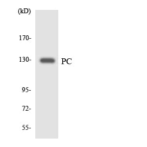 Polyclonal Rabbit anti-Human PC / Pyruvate Carboxylase Antibody (aa341-390, IHC, WB)