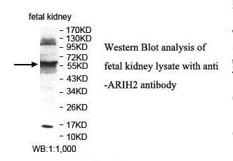 ARIH2 Antibody (aa9-203)