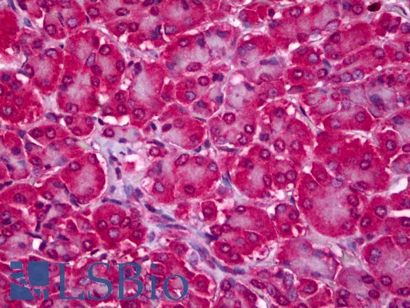 IHC-plus™ RTKN2 Antibody (clone 2C2)