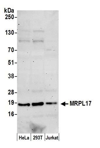 MRPL17 Antibody (aa25-75)