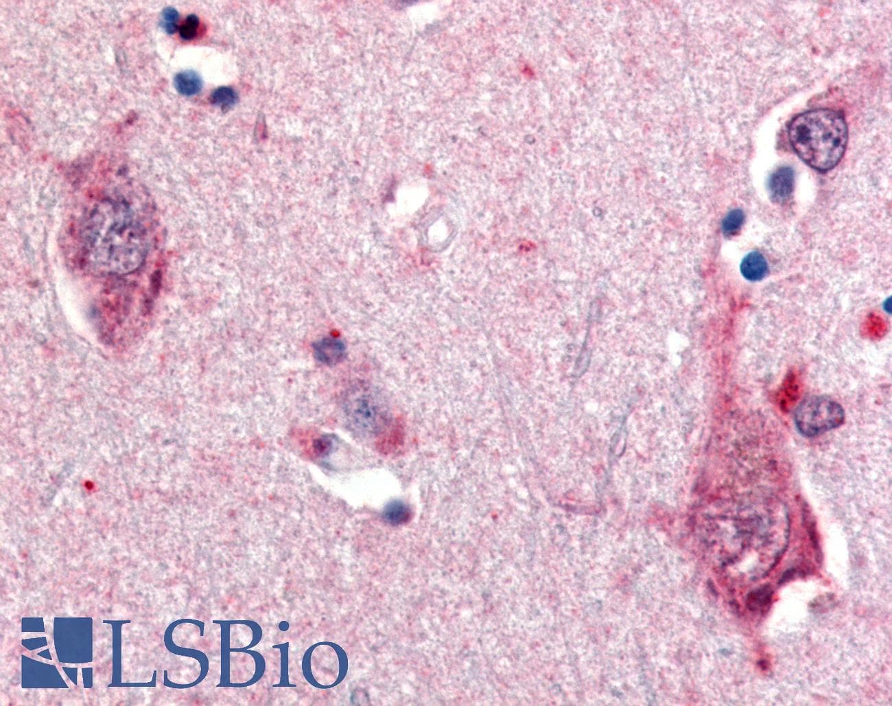 IHC-plus™ Polyclonal Rabbit anti-Human NTRK2 / TRKB Antibody (Cytoplasmic Domain, IHC)