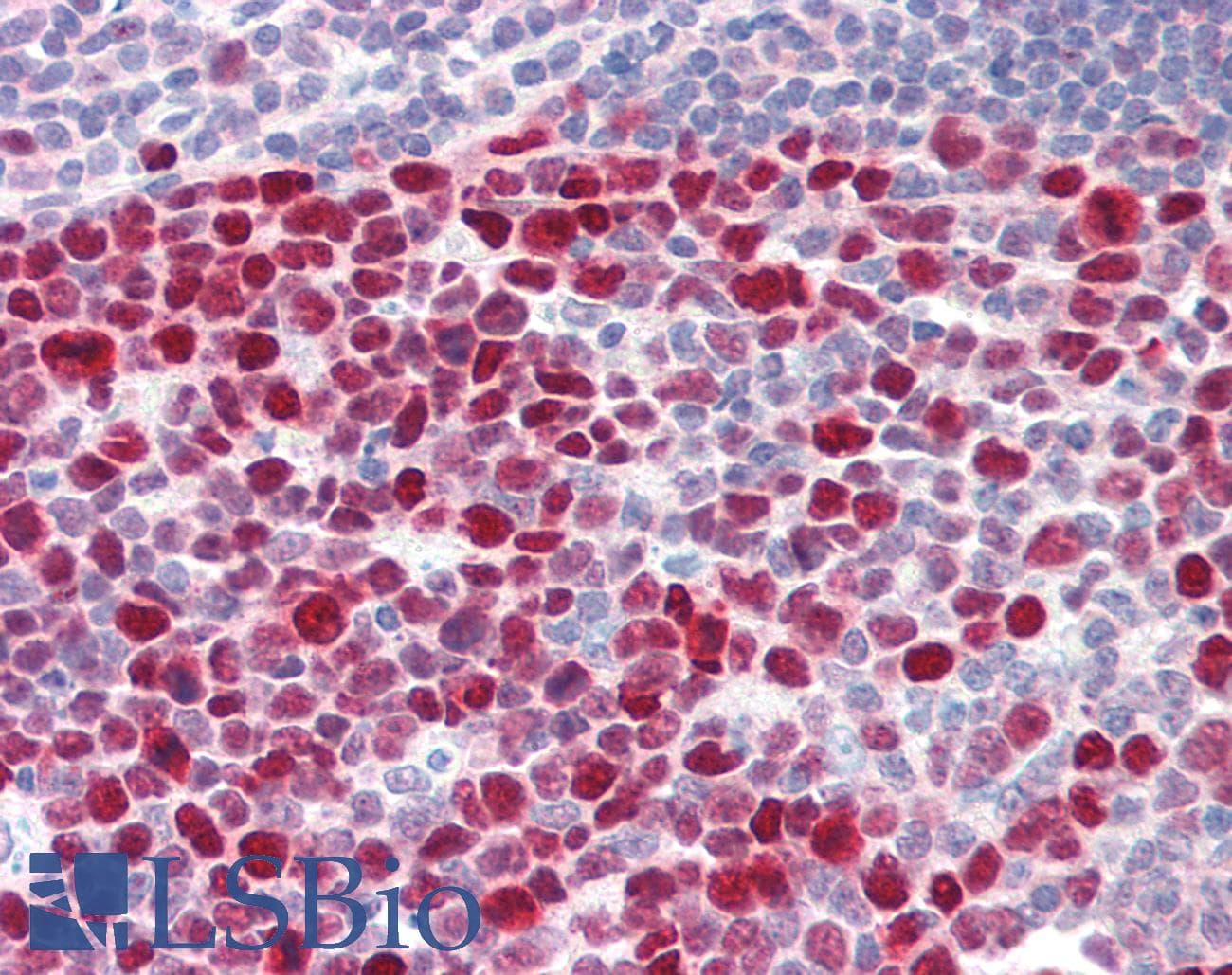 PathPlus™ TOP2A / Topoisomerase II Alpha Antibody
