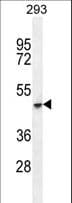 Cochlin / COCH Antibody (aa492-520)
