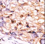 CTDSP1 / SCP1 Antibody (aa235-261)