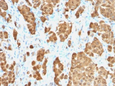 S100B / S100 Beta Antibody (clone S100B/1706R, Azide-free, Carrier-free)