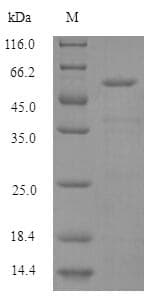 Human HARS Protein (Recombinant 6His, N-terminus)