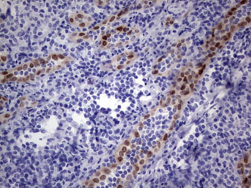 MEOX1 Antibody (clone OTI5B11)