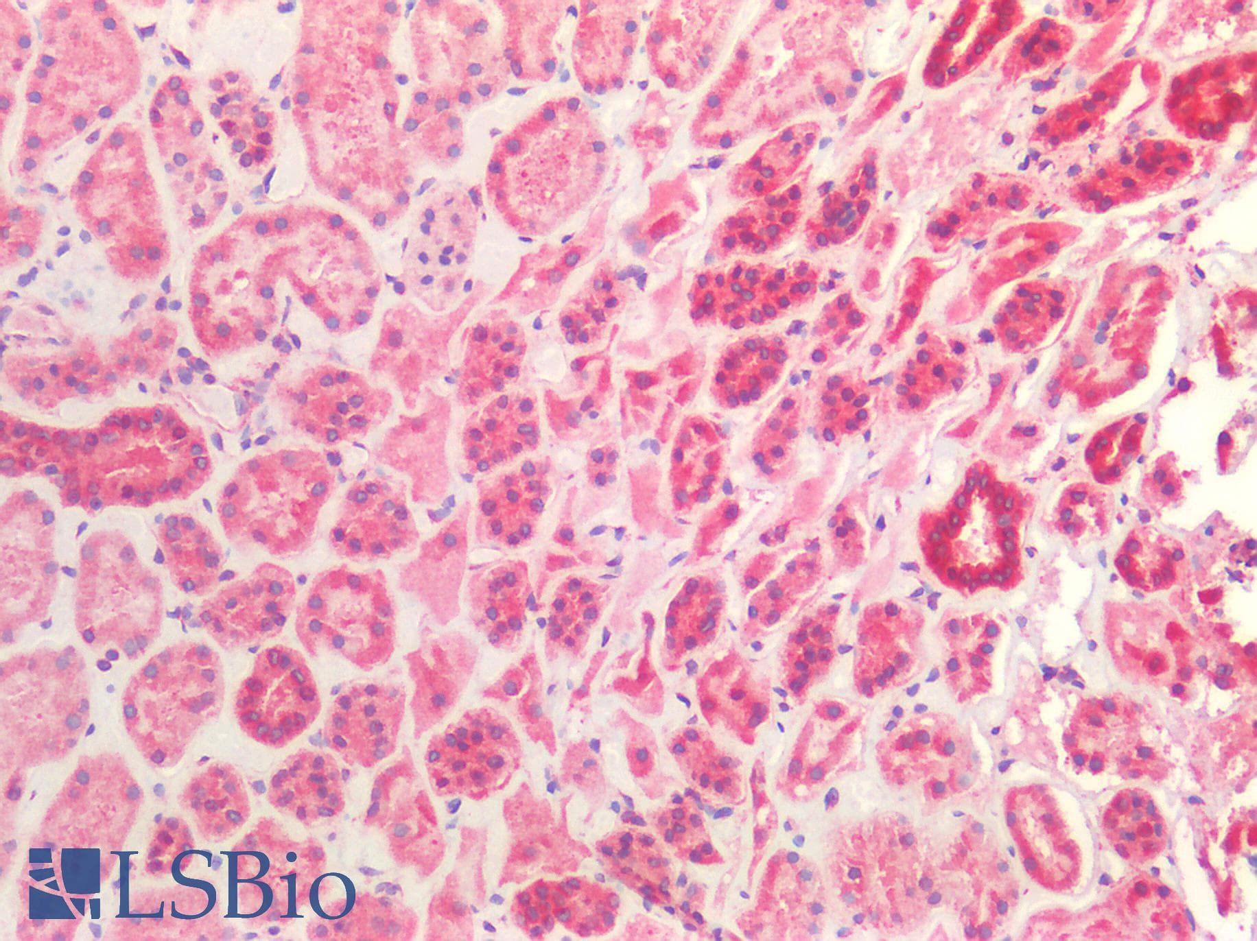 PathPlus™ CTSV / Cathepsin V Antibody (Internal)