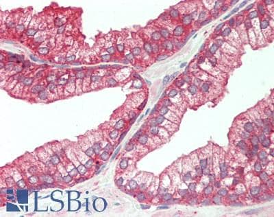 IHC-plus™ Polyclonal Rabbit anti-Human ALDH1A3 Antibody (aa318-348, IHC, WB)