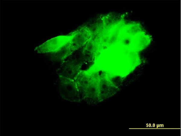 CDC42BPB / MRCKB Antibody (clone 2F4)