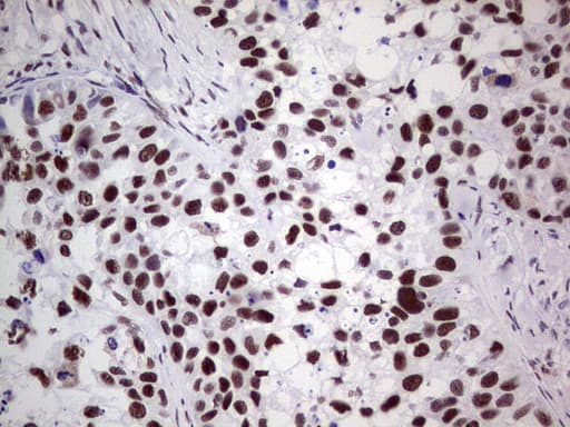 PPP1R8 / Rnase E Antibody (aa1-225, clone OTI5H9)