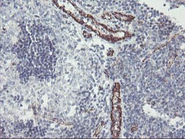 Monoclonal Mouse anti-Human PECAM-1 / CD31 Antibody (clone OTI1C2, IHC, WB)