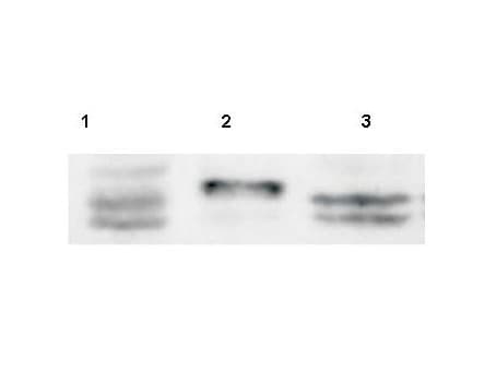 IHC-plus™ Polyclonal Rabbit anti-Human Sprouty 4 / SPRY4 Antibody (aa275-299, IHC, WB)