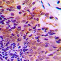 PDCD4 Antibody (C-Terminus)