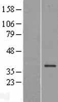 FBXL17 Protein (Over-Expression Lysate Myc-DDK (Flag))