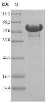 Acinetobacter baylyi catA Protein (Recombinant 6His-SUMO, N-terminus)