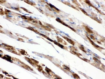 MAOA / Monoamine Oxidase Antibody
