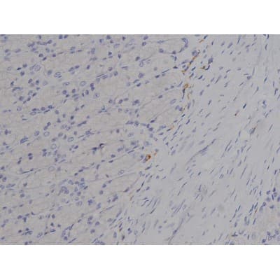 Polyclonal Rabbit anti-Human MAPT / Tau Antibody (phospho-Thr212, IHC, WB)