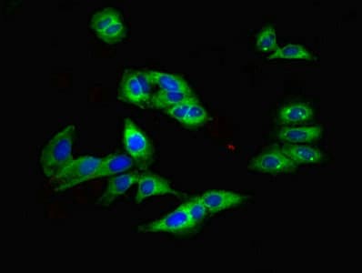 TRPM2 Antibody (aa60-119)
