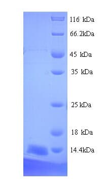 Mouse PSCA Protein (Recombinant His)