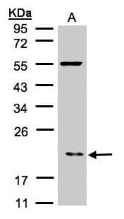 p21-ARC / ARPC3 Antibody (aa1-178)