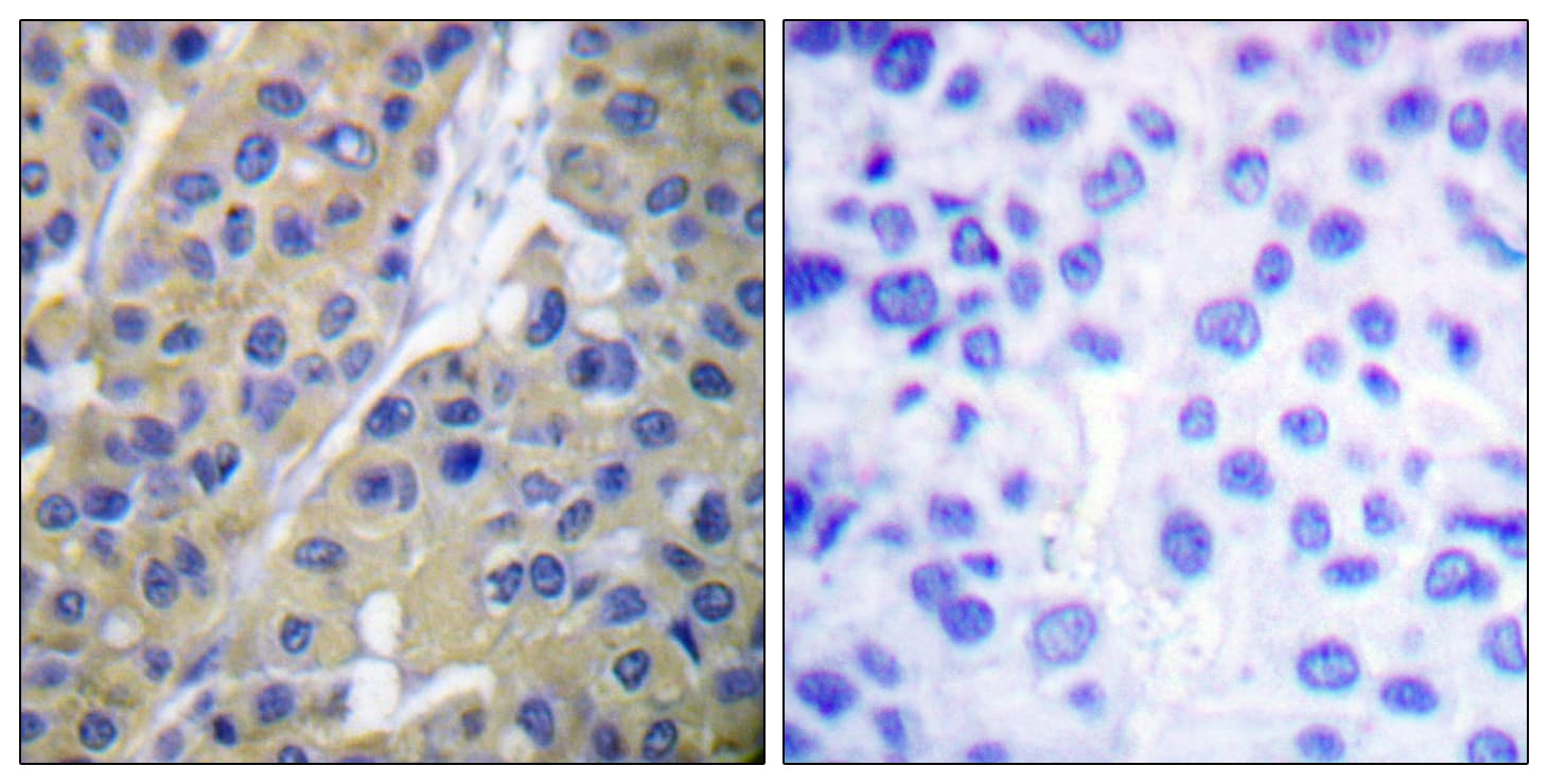 KRT18 / CK18 / Cytokeratin 18 Antibody (phospho-Ser33)