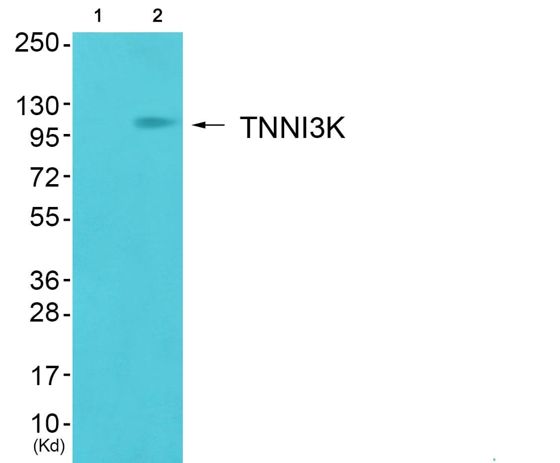 Polyclonal Rabbit anti-Human TNNI3K / CARK Antibody (IHC, WB)