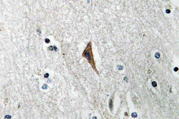 CD144 / CDH5 / VE Cadherin Antibody (phospho-Tyr731)