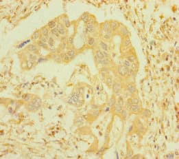 Polyclonal Rabbit anti-Human IFITM5 Antibody (IHC, IF)