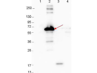 Polyclonal Rabbit anti-Borrelia burgdorferi DbpA Antibody (Lyophilized, WB)