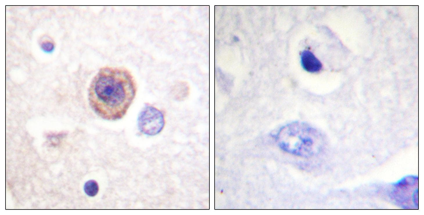 Polyclonal Rabbit anti-Human TPH1 / Tryptophan Hydroxylase Antibody (p58, IHC, IF, WB)