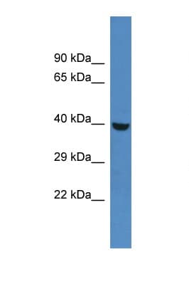 Polyclonal Rabbit anti-Rat PHKG1 Antibody (aa68-117, IHC, WB)