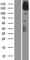 IL31RA Protein (Over-Expression Lysate Myc-DDK (Flag))