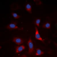 Polyclonal Rabbit anti-Human SMAD3 Antibody (phospho-Ser213, IHC, IF, WB)