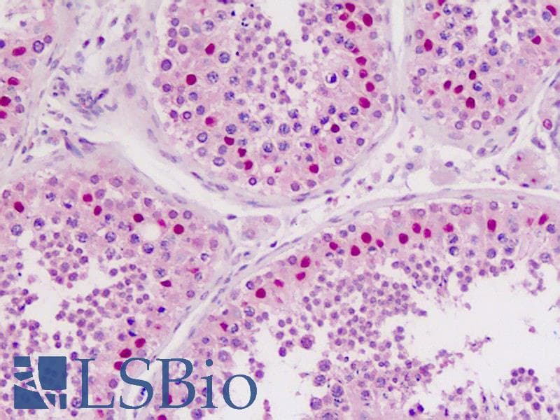 IHC-plus™ CDC25B Antibody (aa165-194)
