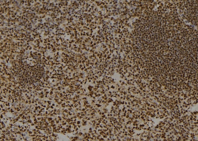 H2AFZ / H2A.z Antibody