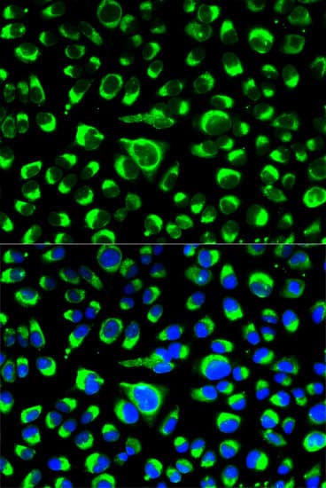 IHC-plus™ PDI / P4HB Antibody