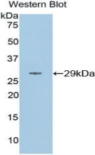 MMP16 Antibody (aa351-557)