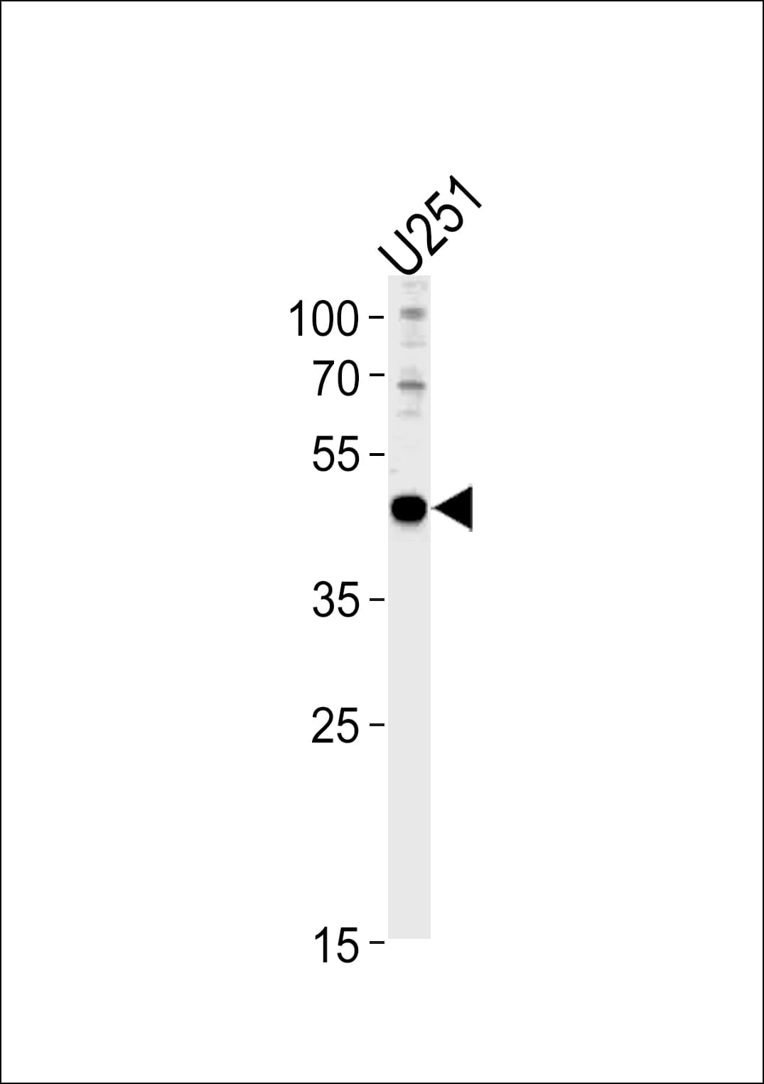 PAX6 Antibody (aa183-210)