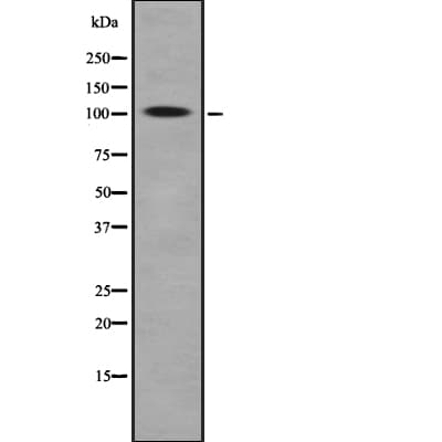 ROR2 Antibody