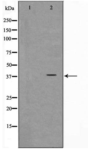 Polyclonal Rabbit anti-Human ARMCX3 Antibody (IHC, IF, WB)