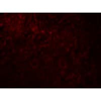 MAGEA4 Antibody
