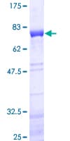 Human NEIL1 Protein (Recombinant GST)