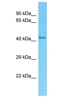 OR52R1 Antibody (aa122-171)