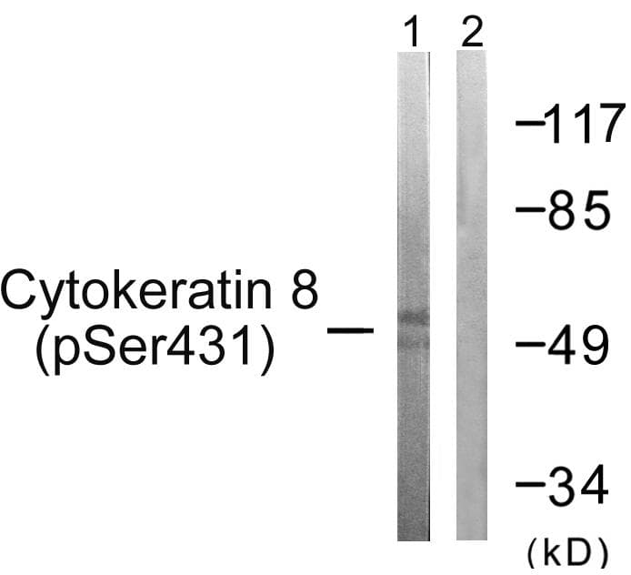 Polyclonal Rabbit anti-Human KRT8 / CK8 / Cytokeratin 8 Antibody (phospho-Ser432, IHC, IF, WB)