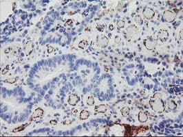 PECAM-1 / CD31 Antibody (clone OTI1B10)