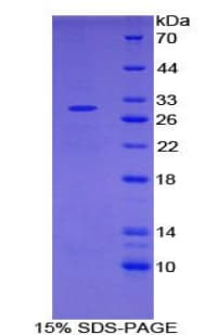Mouse IL2RA / CD25 Protein (Recombinant His-S)