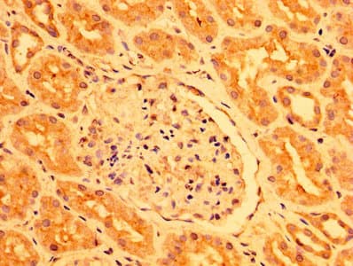 Polyclonal Rabbit anti-Human PEAR1 Antibody (IHC, IF, WB)