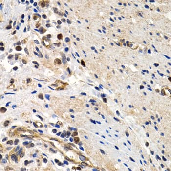 MCM2 Antibody